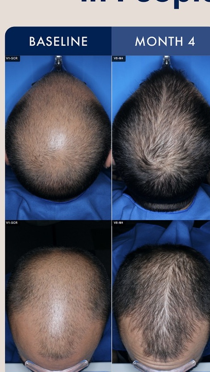 Source photographic comparisons, male cohort example 1