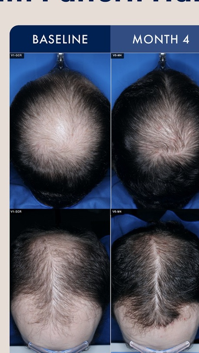 Source photographic comparisons, male cohort example 2