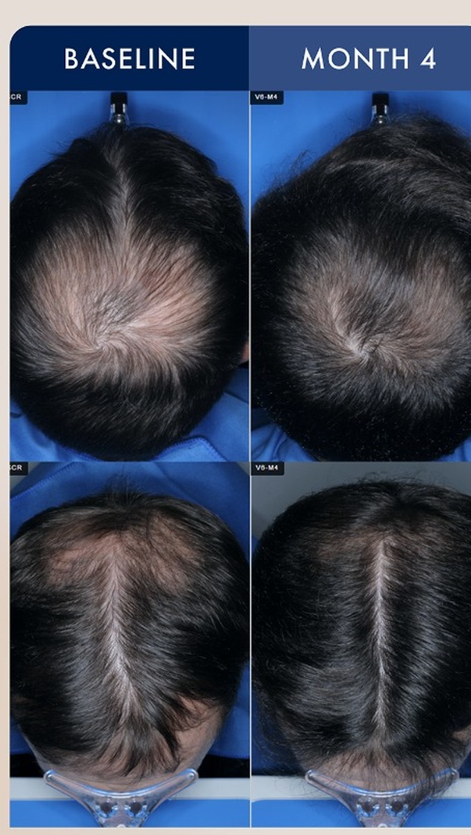 Source photographic comparisons, male cohort example 4