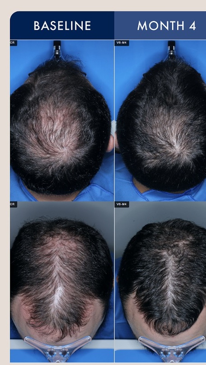Source photographic comparisons, male cohort example 5